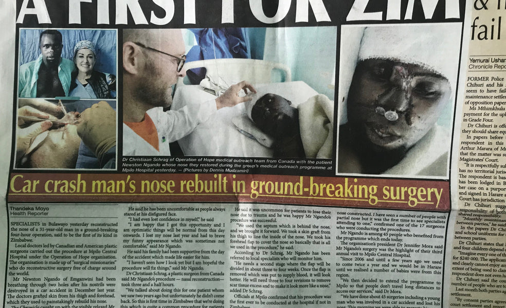 A first for Zim: Car crash man’s nose rebuilt in ground-breaking surgery
